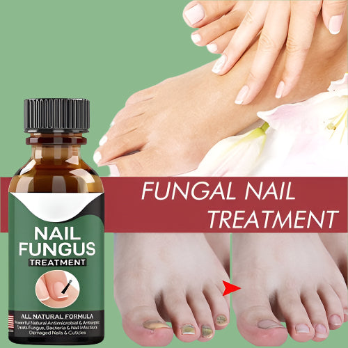 Foot Cure Nail Fungus Solution